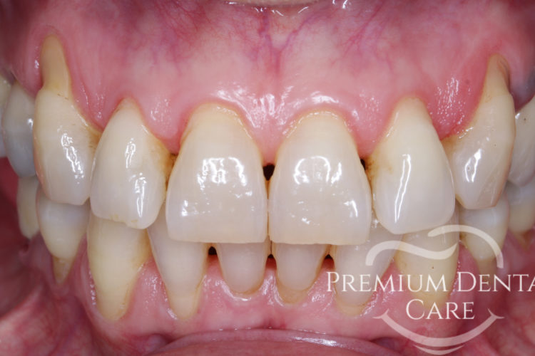 Premium Dental Care Praha