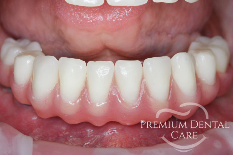 Premium Dental Care Praha