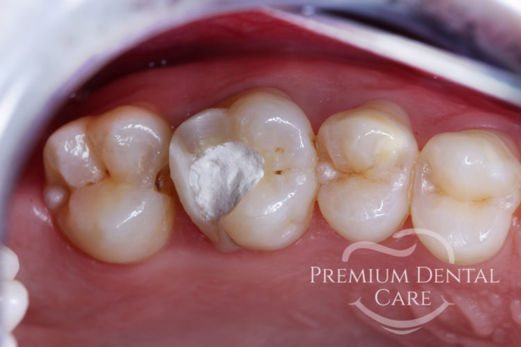 Premium Dental Care Praha
