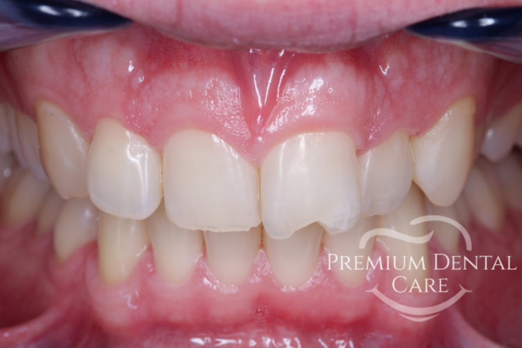Premium Dental Care Praha