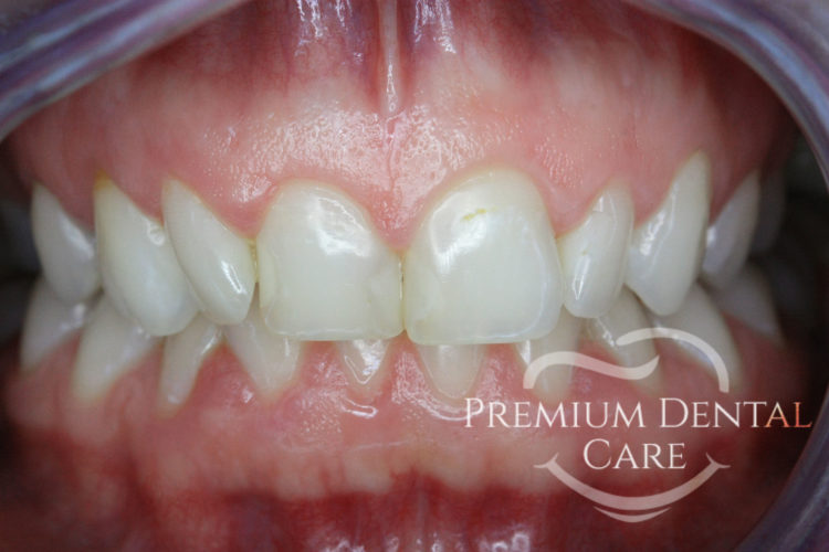 Premium Dental Care Praha