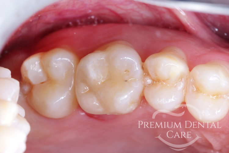 Premium Dental Care Praha