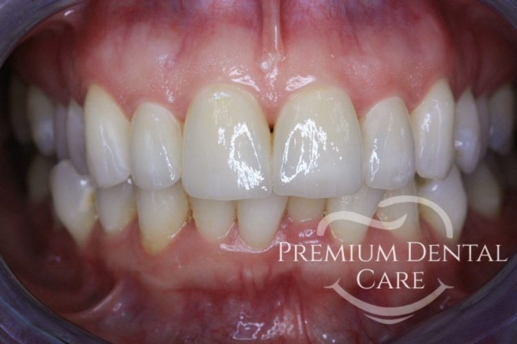 Premium Dental Care Praha
