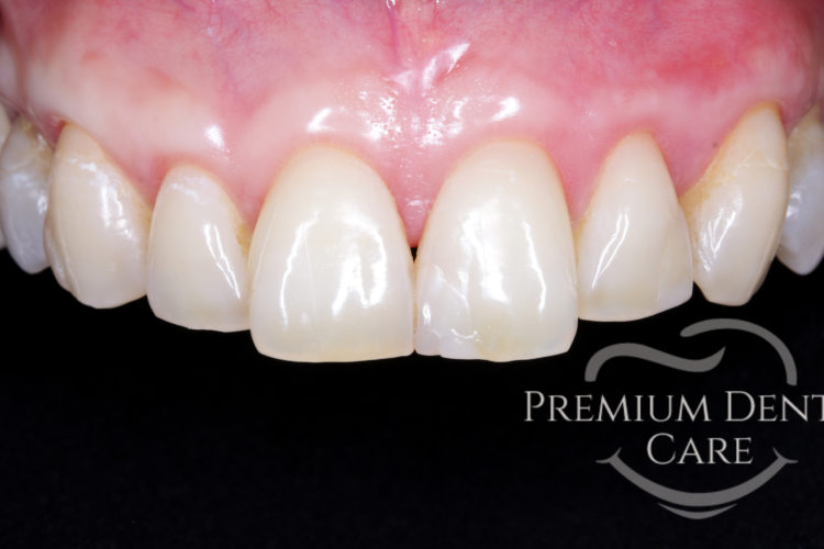 Premium Dental Care Praha