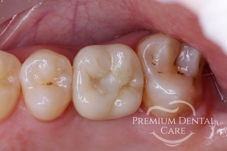 Premium Dental Care Praha