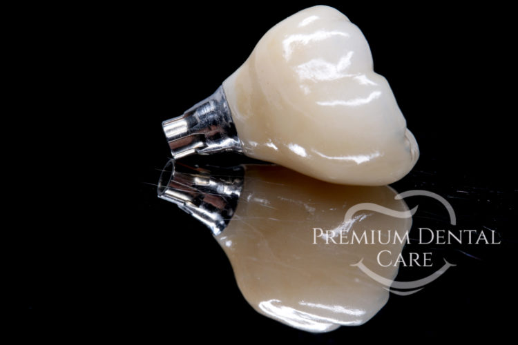 Premium Dental Care Praha