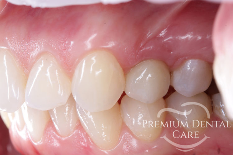 Premium Dental Care Praha