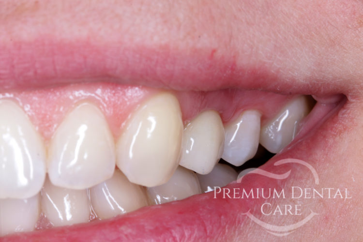 Premium Dental Care Praha