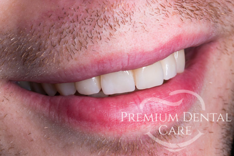 Premium Dental Care Praha