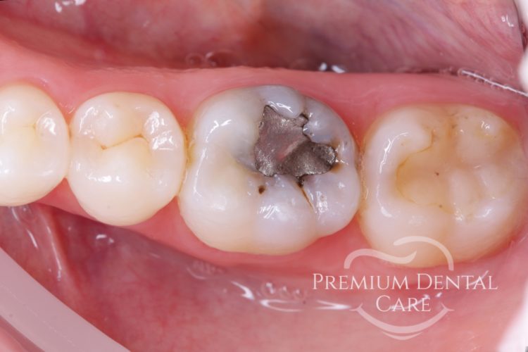 Premium Dental Care Praha