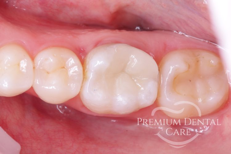 Premium Dental Care Praha