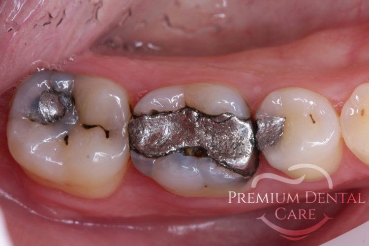 Premium Dental Care Praha